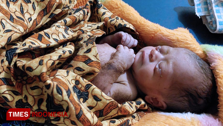 Kondisi bayi yang ditemukan warga Desa Poncogati Kecamatan Curahdami Kabupaten Bondowoso Jawa Timur (FOTO: Tif for TIMES Indonesia)