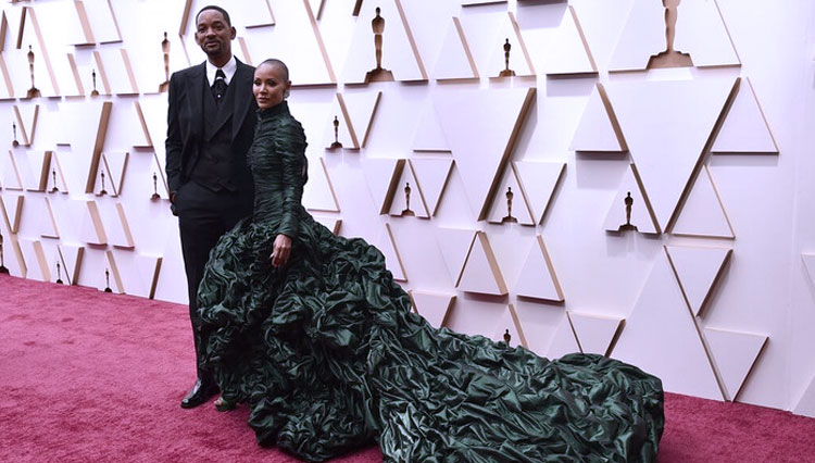 Mengenal Alopecia, Penyakit Autoimun yang Diidap Istri Will Smith