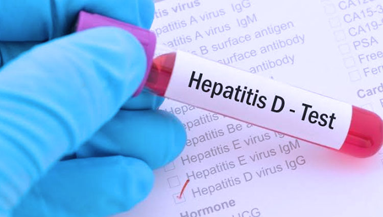 Indonesia Waspada Ancaman Hepatitis Akut