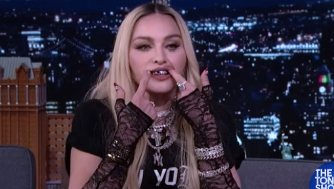 Ultah ke 64, Madonna Hadiahi Diri Sendiri Panggangan Mulut