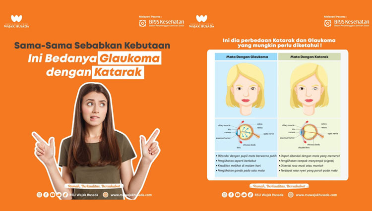 katarak.jpg