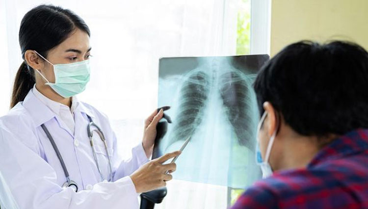 Ilustrasi pasien TBC. (iStockphoto/jittawit.21)