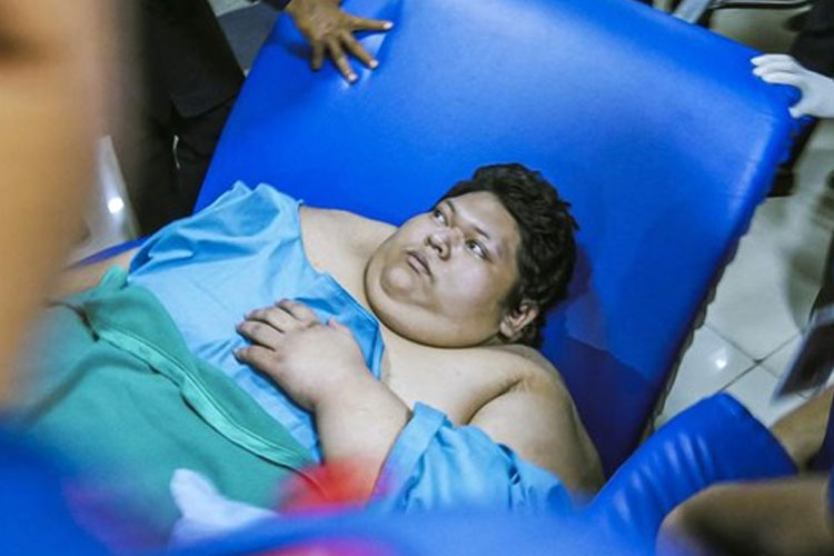 Pria Obesitas Berat 300 Kg Meninggal Dunia setelah Perjuangan Perawatan di RSCM