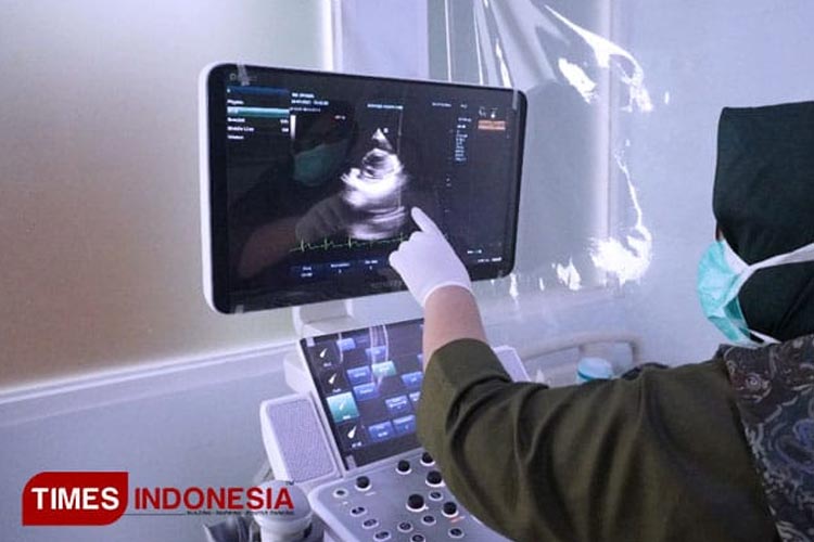 Ilustrasi dokter mengecek ultrasonografi (USG). (Foto Dok. TIMES Indonesia)