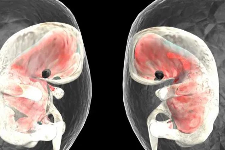 Dokter di Pakistan Temukan Janin dalam Perut Bayi 10 Bulan