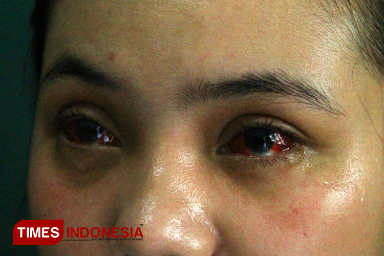 Satu Tahun Tragedi Kanjuruhan, Nafas Panjang Mencari Keadilan (4)