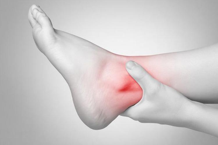 Ilustrasi cedera atau keseleo di pergelangan kaki.