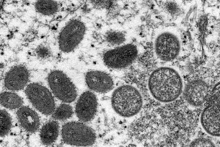 Ilustrasi virus. (cdc)