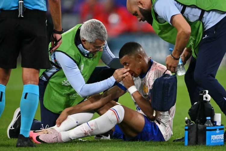 Mbappe Cedera Patah Tulang Hidung Warnai Kemenangan Prancis atas Austria