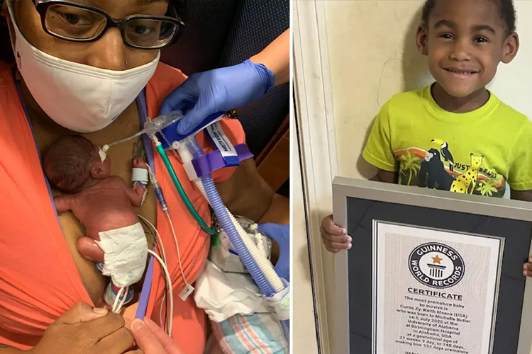 Bandingkan saat tubuh mungil Curtis Zy-Keith Means yang lahir paling prematur di dunia dengan sertifikatnya Guiness World Record. (FOTO: Guiness World Record)