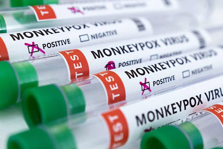 Tabung mini hasil pengujian yang bertanda ''Positif dan Negatif virus cacar monyet'' terlihat dalam ilustrasi yang diambil pada Senin (23/5/2022). (Foto: ANTARA/REUTERS/Dado Ruvic)