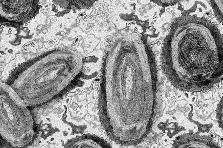 Virus Mpox atau virus cacar monyet. (Foto: antaranews)