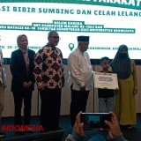 Didukung Tim Dokter dan Akademisi, Operasi BIbir dan Lelangit RSUD Kanjuruhan Rutin Digelar