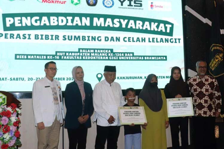 Peduli Anak Bibir Sumbing, FKG UB dan FK Unair Gelar Operasi Gratis di RSUD Kanjuruhan