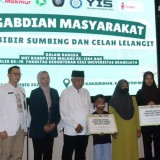 FKG UB Bersama YIS, FK UNAIR, dan RSUD Kanjuruhan Mengadakan Operasi Bibir Sumbing Gratis