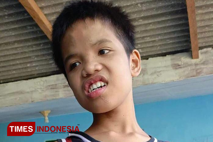 Kisah Anak Berkebutuhan Khusus di Banyuwangi yang Ditinggal Orang Tua