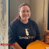 Bareng YPPCBL Sejak 2002, Smile Train Indonesia Bantu Pulihkan Ribuan Penderita Celah Bibir