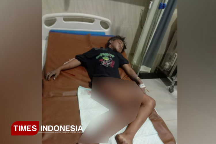 Tiga anak yang jadi korban ledakan mercon. (FOTO: Humas Polresta Cilacap for TIMES Indonesia)