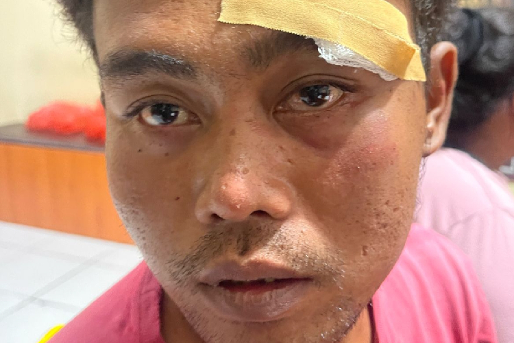 A. (R) alias Resto Dwi Yanti menjadi korban penganiayaan, di Kelurahan Mangga Dua, Polsek Ternate For Times-Indonesia