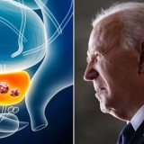 Kanker Prostat Agresif Joe Biden Bikin Para Dokter Top AS Tercengang