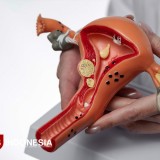Pakar UGM: Virus HPV Bisa Picu Kanker Serviks, Ini Penjelasannya