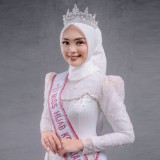 Dhea Anissa Syafitri Suarakan Advokasi Teman Perempuan, Runtuhkan Stigma dan Bangun Ruang Aman