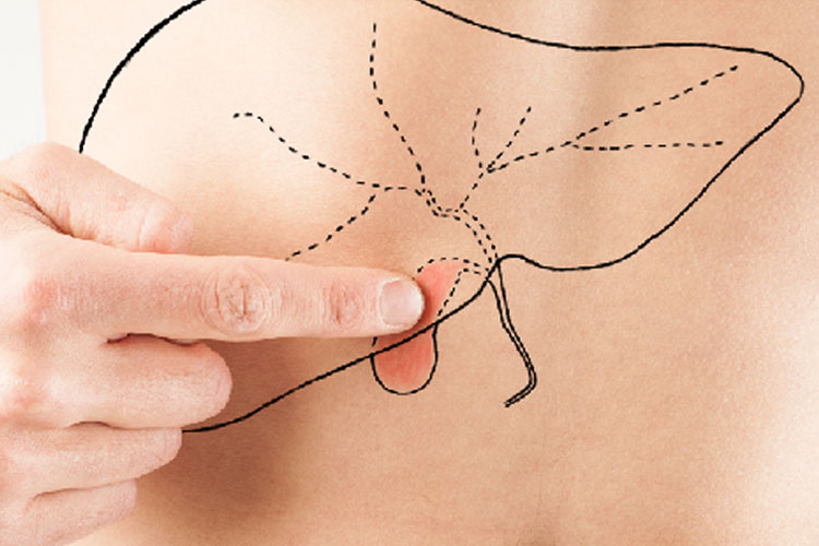 Obesitas dan diabetes sering kali menjadi faktor utama munculnya risiko kanker empedu.