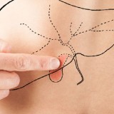 Obesitas dan Diabetes Ancaman Tersembunyi Kanker Empedu