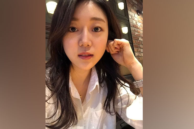 Aktris Korea Selatan Kang Seo-ha meninggal akibat kanker lambung di usia 31 tahun. Apa itu kanker lambung? (FOTO: Instagram/@yewonyewoni)