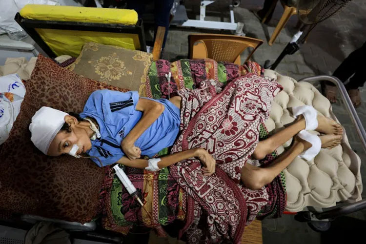 Seorang anak di pengungsian dalam kondisi sakit dan malnutrisi menyusul blokade bantuan pangan dan obat yang dilakukan Israel. Sedikitnya 15 warga Palestina, termasuk empat anak-anak, dilaporkan meninggal dunia akibat kelaparan. (foto: Aljazerra)