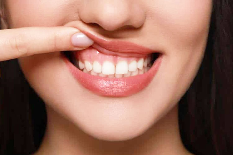 Mengapa Fluoride Penting untuk Kesehatan Gigi?