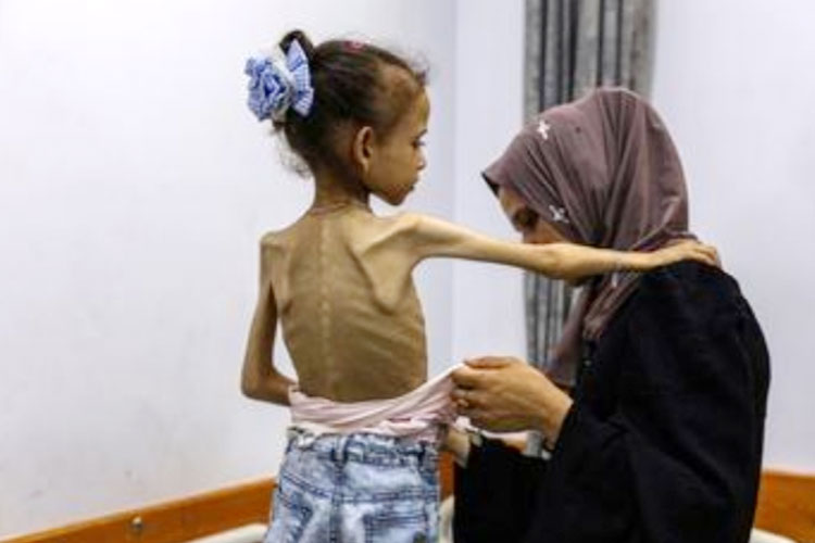 Kelaparan di Gaza Sudah Sampai Fase 5, Sebuah Tingkatan Terburuk