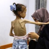 Kelaparan di Gaza Sudah Sampai Fase 5, Sebuah Tingkatan Terburuk