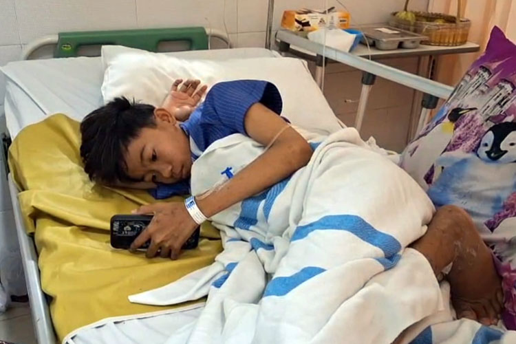 Syaiful Rossy Abdillah salah satu korban selamat dari reruntuhan Musala Ponpes Al-Khoziny Sidoarjo membutuhkan kaki palsu usai kaki kanannya diamputasi. (FOTO: Dok. Istimewa)