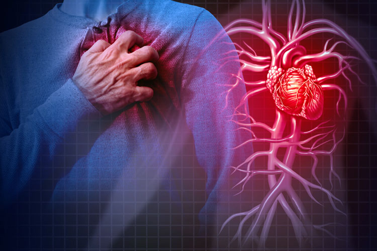 Penyebab utama kematian mendadak pada usia muda adalah aritmia. (Foto: iStock)