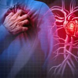 Aritmia, Pembunuh Sunyi di Usia Muda