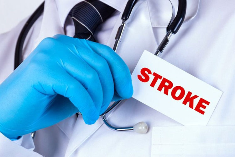 Kunci Pulih dari Stroke, Dokter Ungkap Peran Penting Nutrisi Otak