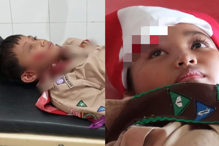 Ingin Pecahkan Rekor Muri, Dua Anak Pramuka Banyunas Malah Luka Kena Pesawat Mini