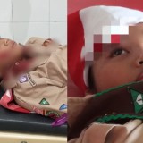 Ingin Pecahkan Rekor Muri, Dua Anak Pramuka Banyunas Malah Luka Kena Pesawat Mini