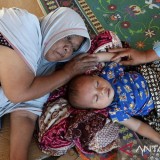 Dokter Anak Ungkap Bahaya Superflu bagi Anak dengan Komorbid, Ini Langkah Pencegahan yang Disarankan