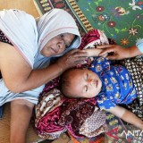 Influenza A Mengintai Anak dengan Komorbid, Dokter Ingatkan Risiko Serius