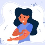 Akademisi UGM Ingatkan Pentingnya Deteksi Dini Kusta di Masyarakat