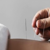 Akupunktur Estetika Wajah, Opsi Medis untuk Kulit Lebih Cerah