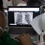 Batuk Tak Kunjung Sembuh, Dokter Ungkap Tanda Awal TBC pada Anak dan Dewasa